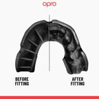 PARADENTI ADIDAS OPRO BRACES GOLD